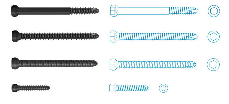 Interlocking Nails Uses, Sizes & Surgical Techniques • Vast Ortho