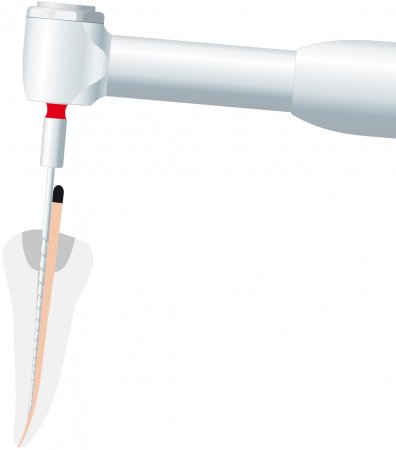 Endodoncie