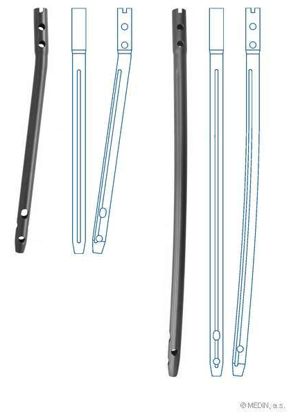 A) and (B) Radiographs of the fractured distal femur showing a... |  Download Scientific Diagram